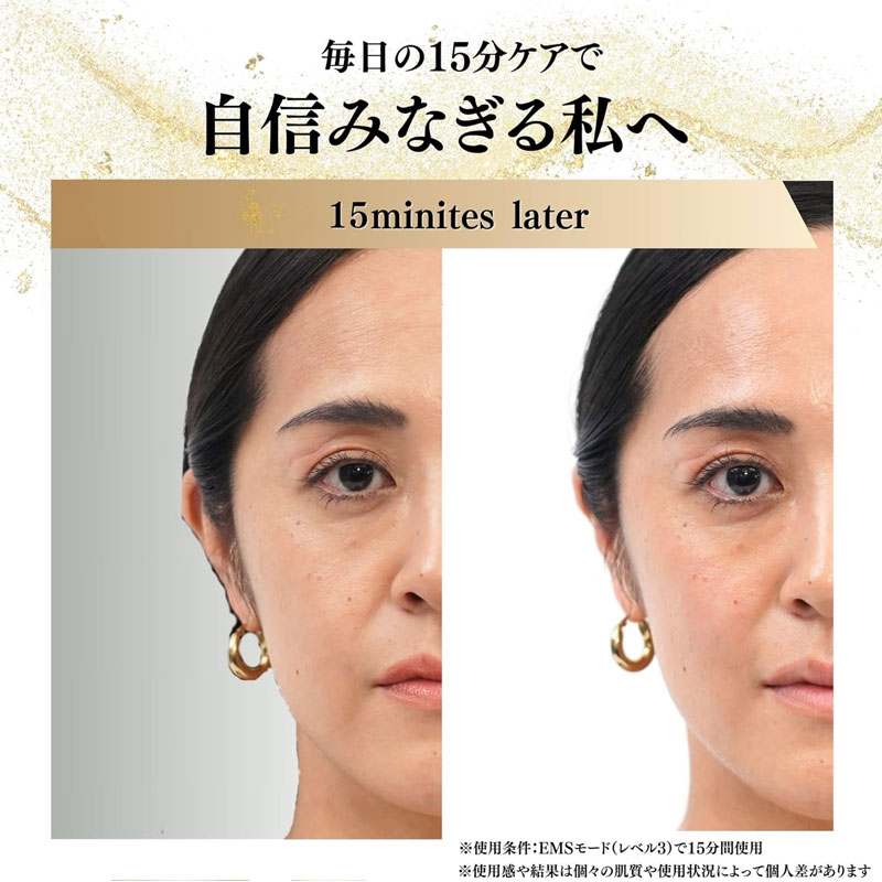 Súng massage chăm sóc toàn diện cơ thể: đầu, mặt, toàn thân STEADY ST-150 Nhật Bản - Ảnh 2